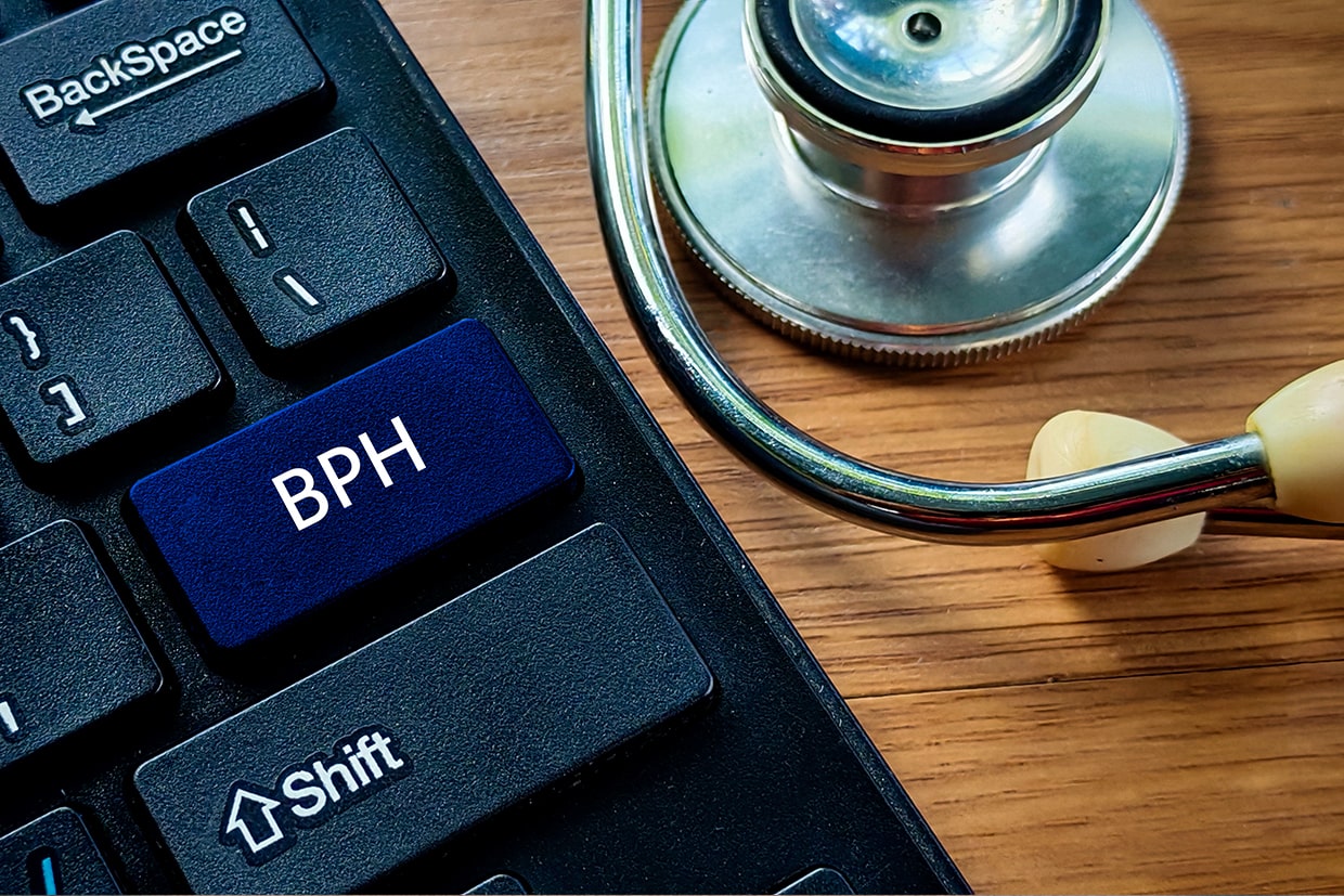 Frequently Asked Questions for BPH (Benign Prostatic Hyperplasia)