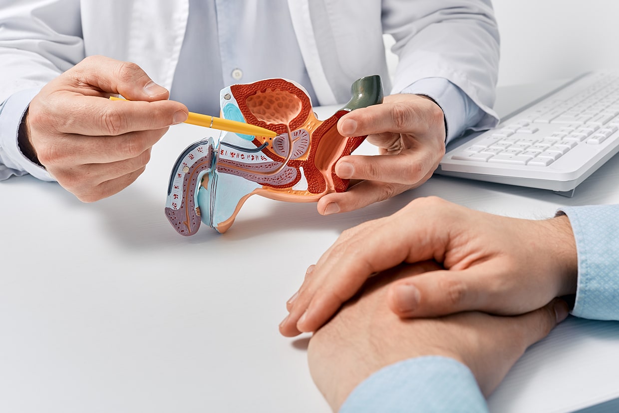 Frequently Asked Questions for Prostate Cancer Diagnosis at Northwoods Urology