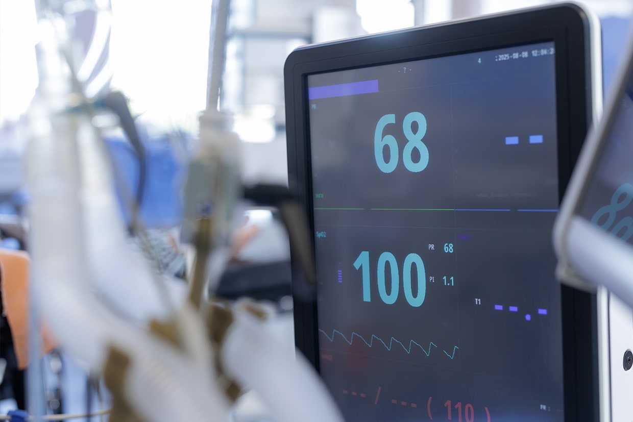 Frequently Asked Questions about Nitroseal Sedation